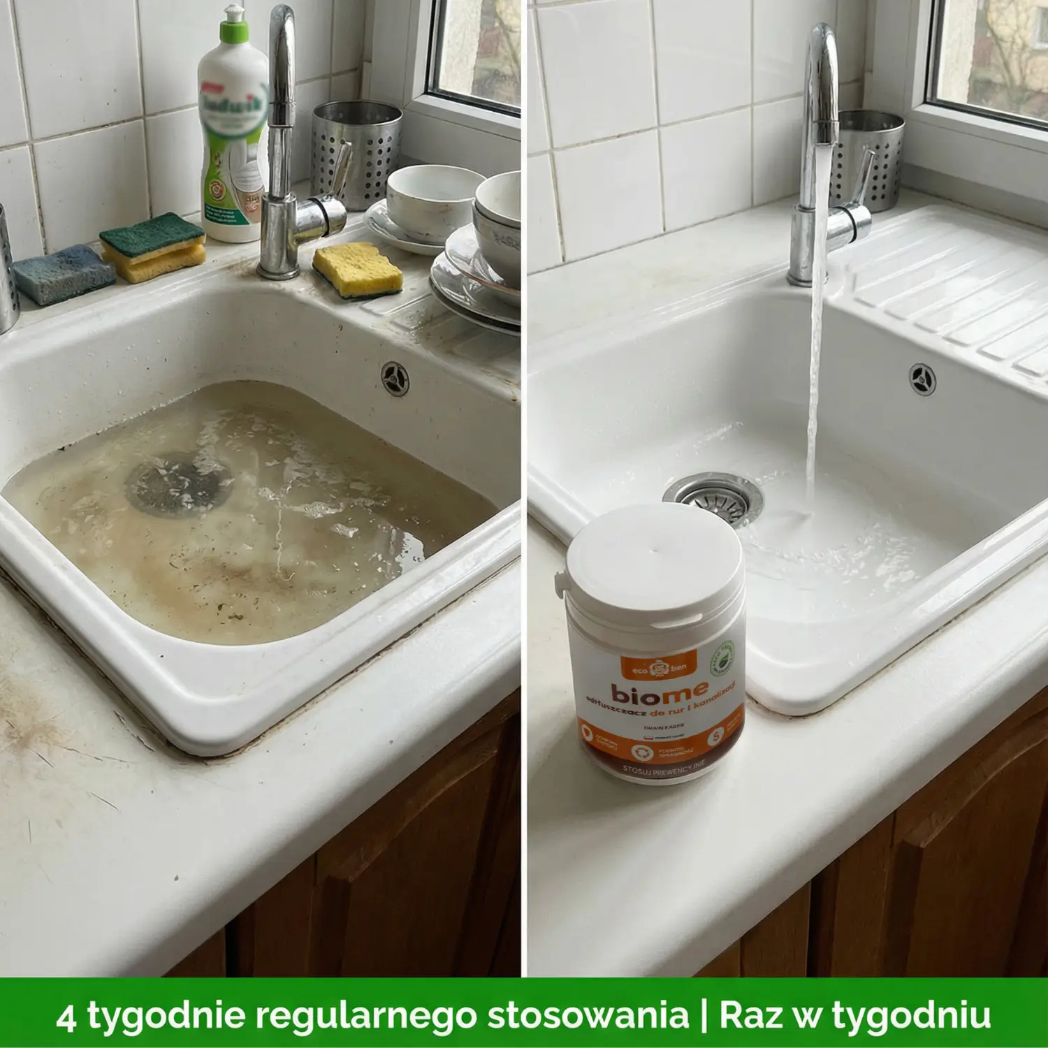 Kożuch tłuszczowy przed